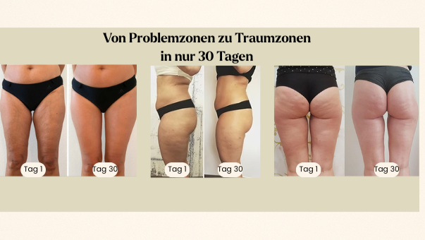 NUVÉA SHAPE - Anti-Cellulite-Massagegerät